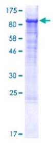 SDS-PAGE (ITGB1-4986H).jpg
